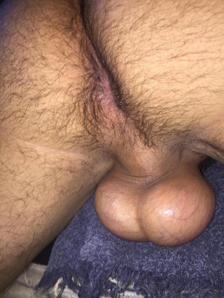 Огромные волосатые яйца