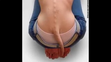 Рудимтальный хвост у человека